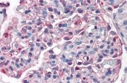SLC39A14 Antibody, Novus Biologicals 50 &mu;g; Unconjugated:Antibodies,